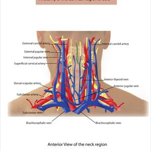 Information Varicose Vein - Varicose Veins Surgery