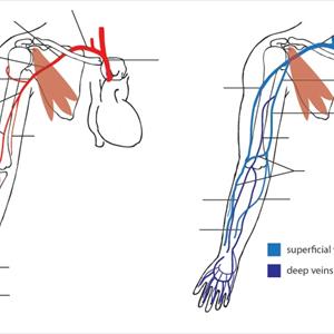 Varicosities Drawings - What You Need To Know About The Different Types Of Varicose Veins Surgeries