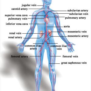 About Varicose Veins - Varicose Veins Diagnosis
