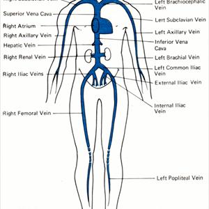 Varicosities Gifs - Detailed Information On Varicose Veins